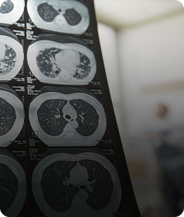 CT scan images on a light board
